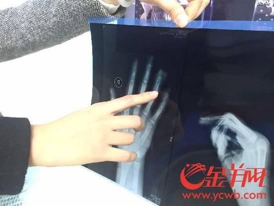 С�^(q��)�������ĊA��ָ����С��ָ�Ǳ��A���� 