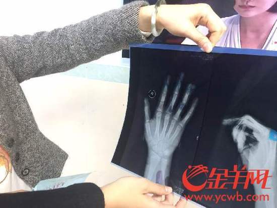 С�^(q��)�������ĊA��ָ����С��ָ�Ǳ��A���� 